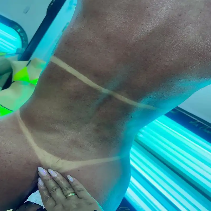 CAMARA DE BRONCEO TECNICA BRASILERA - Imagen 1